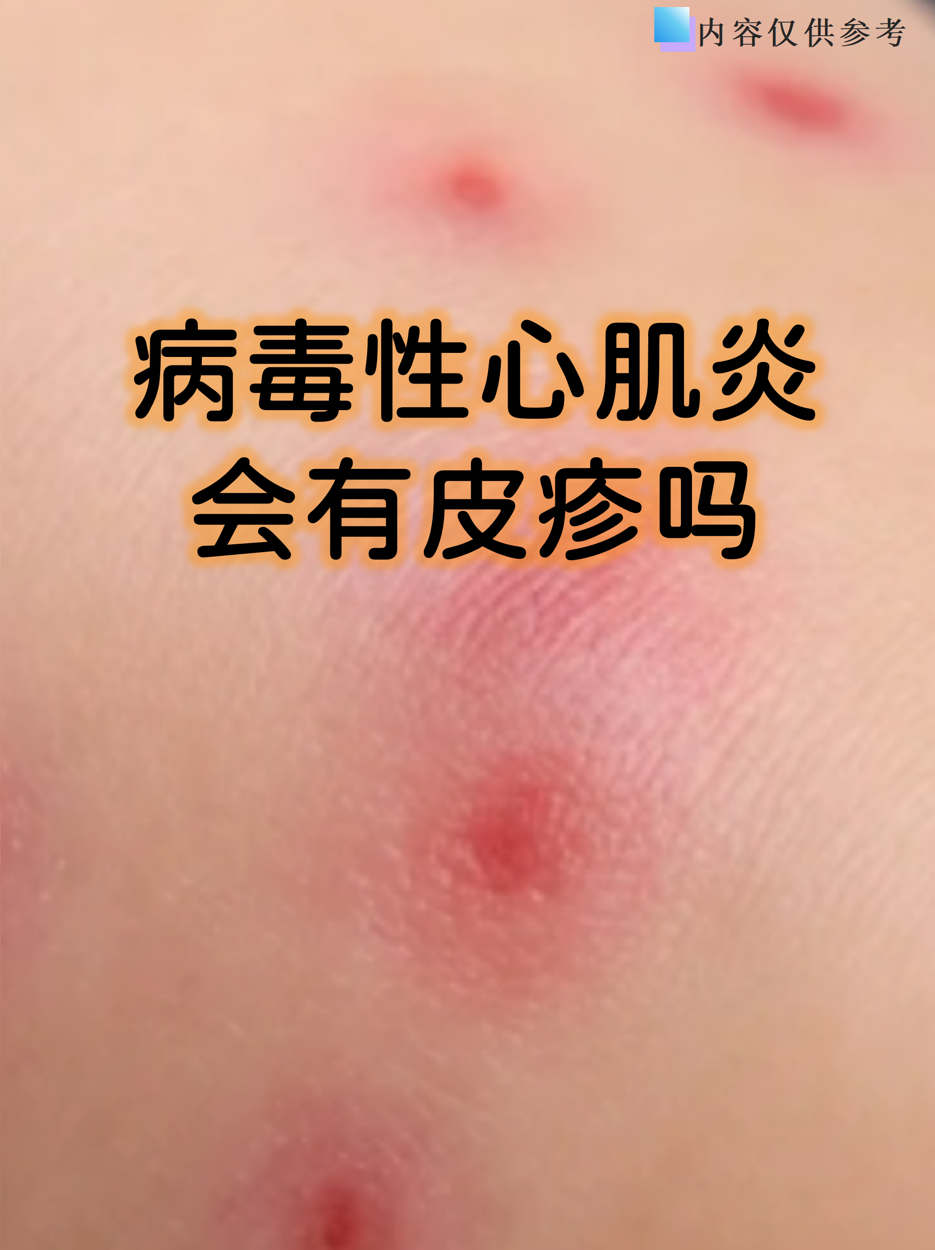 病毒爆发-19年什么病毒爆发-第2张图片
