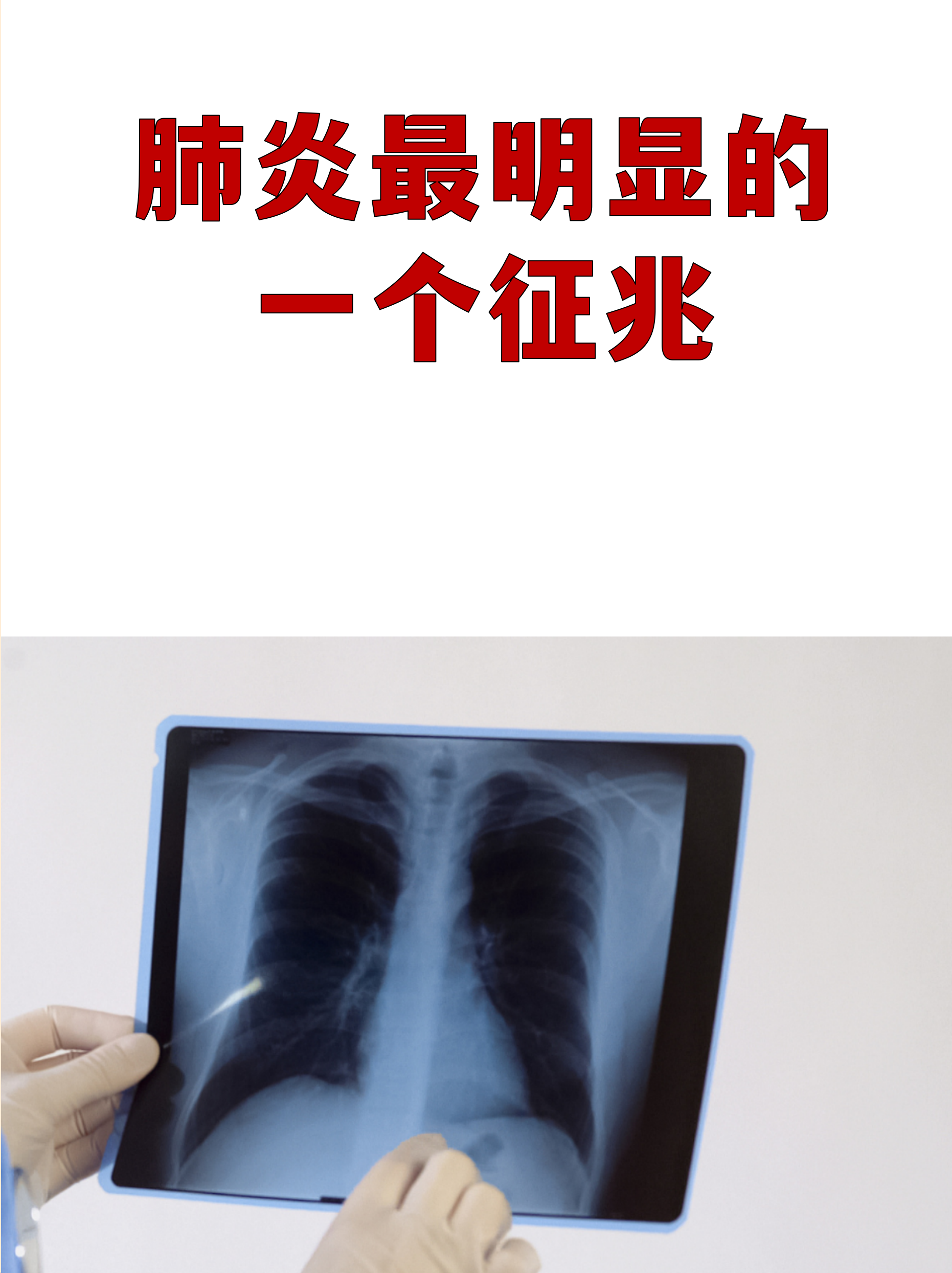 黑龙江新增43例确诊31例无症状.黑龙江新增43例确诊31例无症状感染者-第1张图片