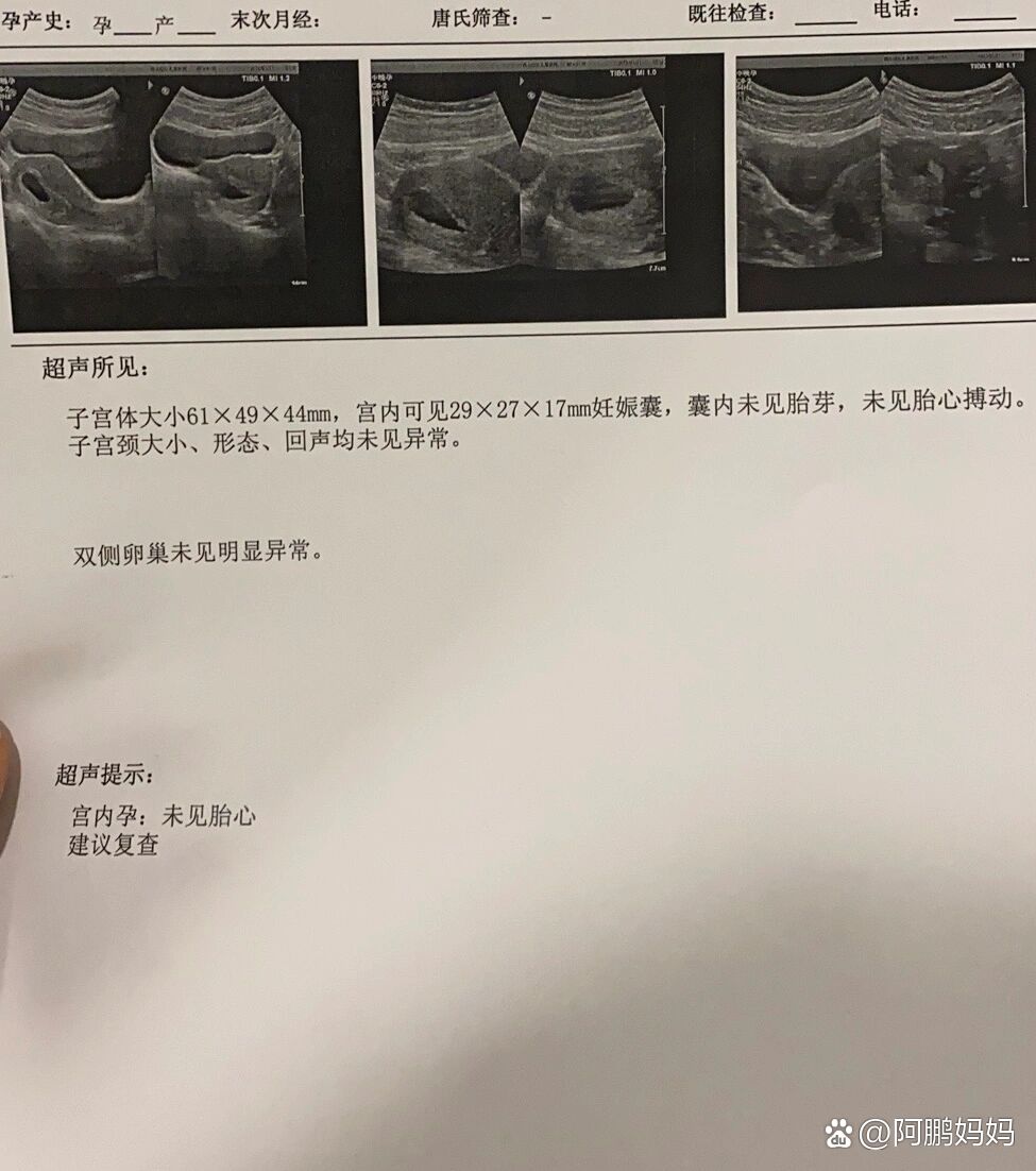 分享实测“有没有优乐字牌可以装挂吗	”分享用挂教程-第1张图片