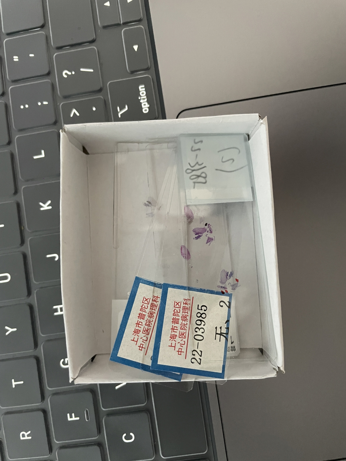 上海累计确诊病例,上海确诊多少例-第1张图片
