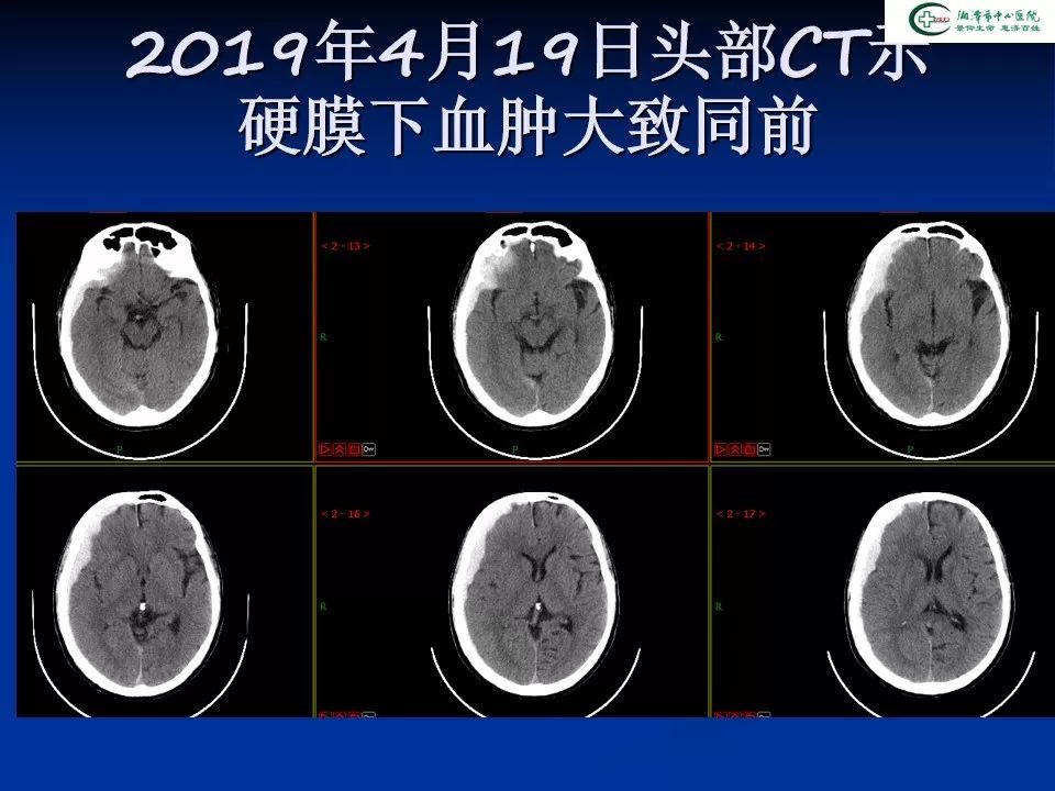 沧州新增1例的简单介绍-第1张图片
