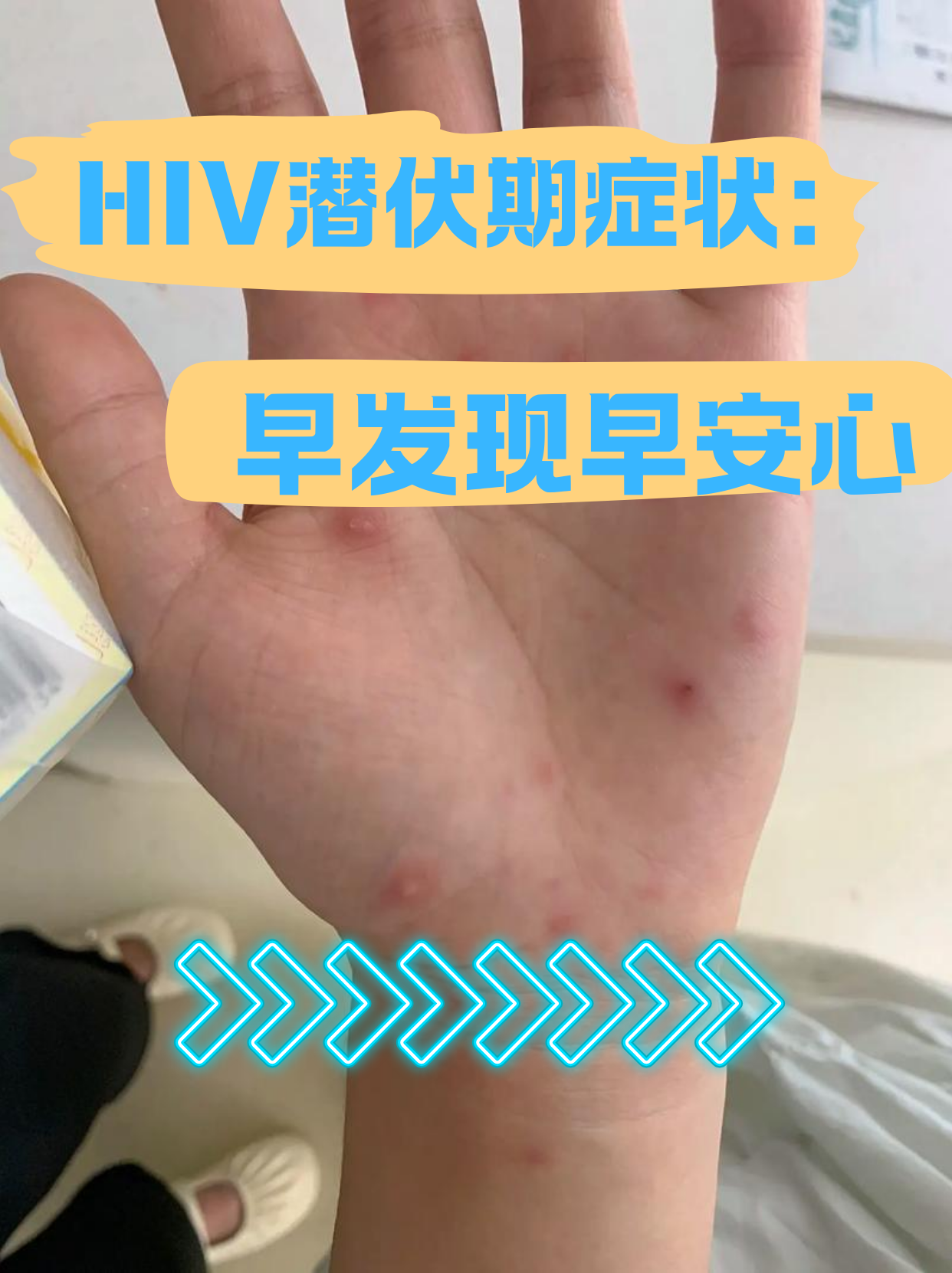 第二波感染高峰预测〃第二波疫情有什么症状-第2张图片