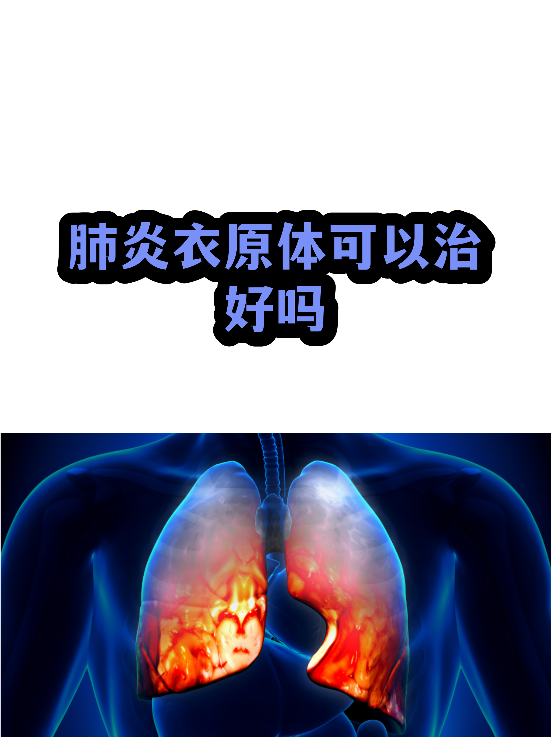 「本次疫情叫什么」〃本次疫情什么症状-第2张图片